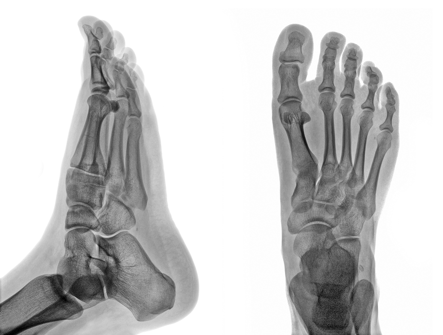 X Ray Fluoroscopy Greater Flint Imaging x-ray-fluoroscopy-greater-flint-imaging