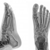 x-ray-fluoroscopy-greater-flint-imaging